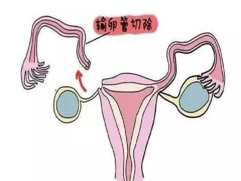 北京供卵试管中介服务公司排名（北京供卵生殖医院）
